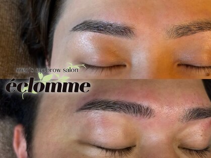 エクロム(eclomme)の写真