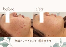女神デトックス 長野店