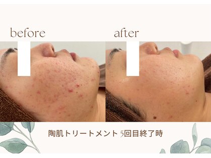 女神デトックス 長野店の写真