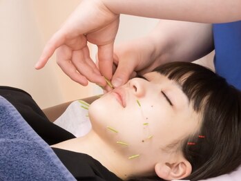 小林整骨院 東高円寺の写真/【美容鍼】美顔鍼でくすみやしわ・たるみ改善☆国家資格を持つ鍼灸師がお悩みに合わせて施術いたします！