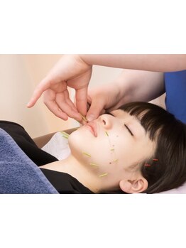 鍼灸施術を受けたい