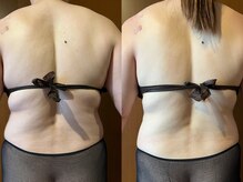 マロカ(Marroka)/40代。何をしても痩せなかった方