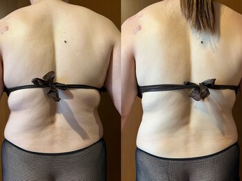 マロカ(Marroka)/40代。何をしても痩せなかった方