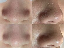 ドルチェ(Dolce)の雰囲気(韓国式3D毛穴洗浄で毛穴奥の汚れや古い角質の除去が可能◎)