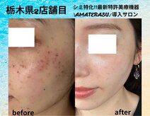 エイチケービューティーサロン(H/K beauty salon)