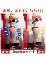 ビューティサロン キヨの部屋(beauty salon)/【軟部組織セラピー】　１回