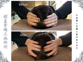 ボディ リセット アンド デザイン(Body Reset & Design)/【施術例】ビフォーアフター