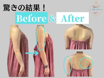フローフシ∞/【二の腕BA】華奢な肩・二の腕