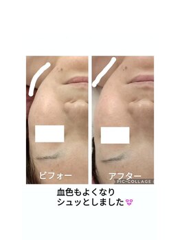 ペタル(petale)/小顔に★