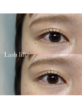 シェア(Eyelash&Nail share)/まつげパーマ