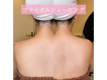 リンド エステ まつげ 京成大久保(Lind)/ブライダルシェービング