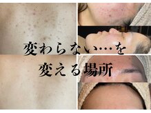 ビューティータワー(Beauty Tower)の雰囲気（自信の実績ハーブピーリング）