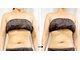 ルアナライフ(Luana Life)の写真/REDSHOTとキャビゼロでその日にサイズダウンを目指す、むくみ対策の排出サポート体験◎