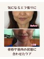 真心美 【小顔/フェイシャル/ヘッドスパ/ヘッドマッサージ】