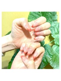 クリアベース×フレンチ