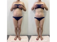 ルクール(Le Couer)/50代２ヶ月後