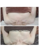 イベリス(IBERIS.)/当店ビフォーアフター