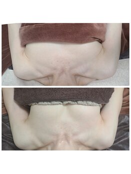 イベリス(IBERIS.)/当店ビフォーアフター