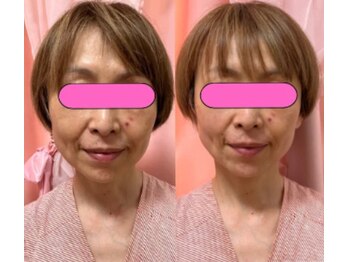 サロンペタル 浦安(Salon Petal)/左右のバランスも整いました！