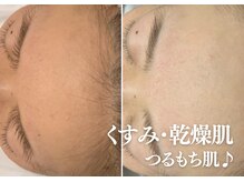 気になるくすみや乾燥にも＾＾フェイシャルトーンアップ◎