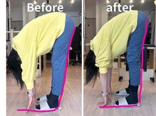 ピース(Peace)/before after