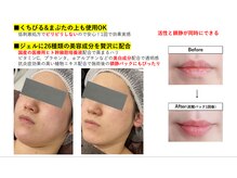 ウル(Ulu)/【高濃度ヒト幹導入炭酸パック】