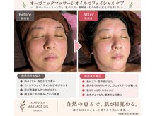 レヴォーテ 練馬(Re-Beaute)/トーンアップ、むくみ改善