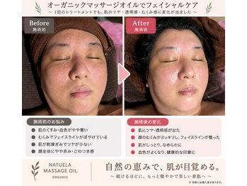 レヴォーテ 練馬(Re-Beaute)/トーンアップ、むくみ改善