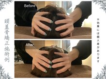 ボディ リセット アンド デザイン(Body Reset & Design)/【施術例】ビフォーアフター