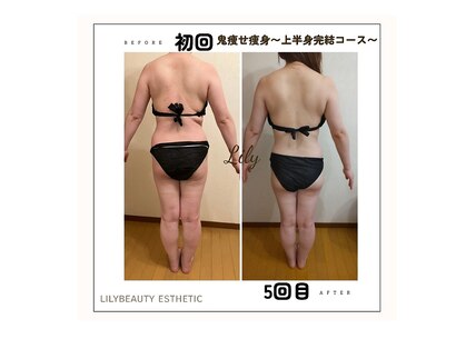 リリービューティー(lily beauty)の写真