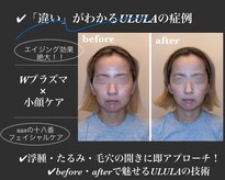 ウルラ(ULULA)