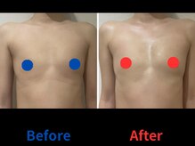 ポインセチア(Poinsettia)/ダイナミックバスト4DX/並び比較