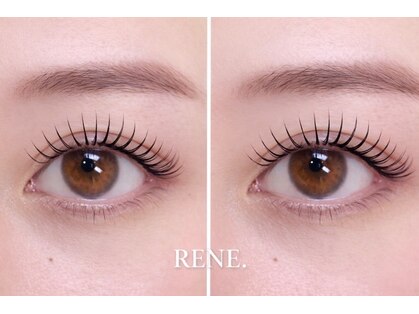 RENE.【3月1日OPEN(予定)】の写真