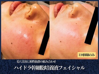 エヴァーグレース 栄店の写真