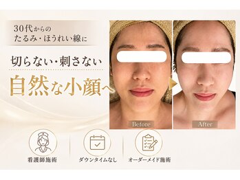 エン 橿原店(en)の写真/30代からのたるみ・ほうれい線のお悩みに。筋肉×脂肪のWアプローチで若々しいフェイスラインへ。