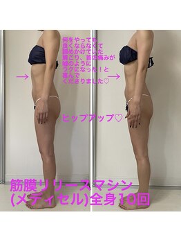 セルビューティー(Cell Beauty)/30代、筋膜リリース全身10回