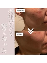 シェリーク 東京店/クリニックからエステへ