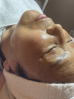 スパークル/毛穴洗浄/ワックス/脱毛