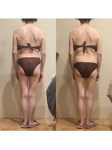 トトノエル(TOTONOEL)/肩こり腰痛筋膜リリース