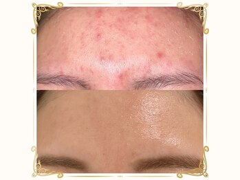 ベルーム(BellRoom)/