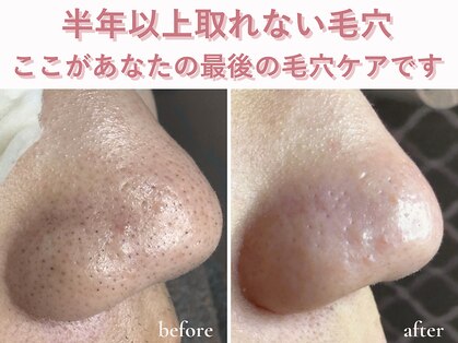 エアル(earu.)の写真