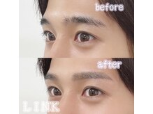 リンク(LINK)/下がり眉でお悩みの方
