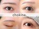 チョキナ(chokina.)の写真