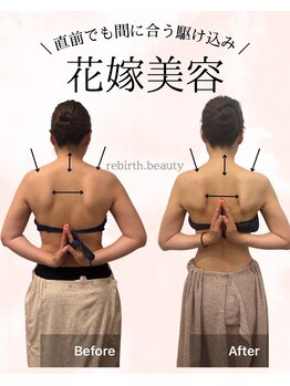 リバース(Rebirth)/姿勢改善x ハイパーナイフ導入