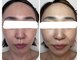 カヤ(KAYA)の写真/大人肌に、うるおいとハリ・ツヤを。ヒト幹細胞培養上清液を使用したスペシャルエイジングケア