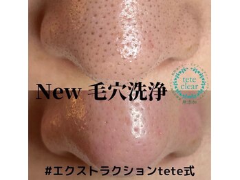 リーインカーナ アーティスト(REINCARNA ARTIST)/【毛穴】エクストラクション