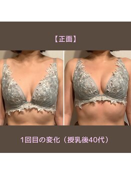 ふじこのきもち/初回の変化　40代授乳後