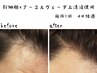 【幹細胞×アーユルヴェーダ】強髪ケア　細毛対策・髪質改善♪4,980→3,980