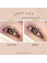 ナチュラル ビューティー ベルポート(natural beauty Bellport)/ラッシュリフトビフォーアフター