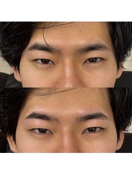 アルデオンワン セカンド(ARDEON.1 second)/【メンズ眉毛】Before/after